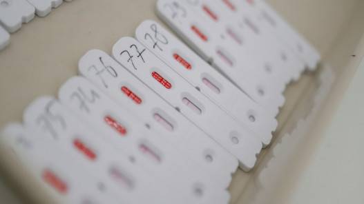 4 وفيات و933 إصابة جديدة بفيروس كورونا في الأراضي الفلسطينية