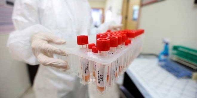 123 إصابة جديدة بكورونا في الجزائر