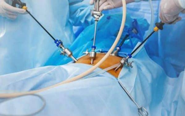 مؤتمر طبي يناقش امراض السمنة ويعرض خلاله عمليات سمنة حديثة في الكندي