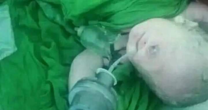 ولادة طفل يمني بعين واحدة!!!!