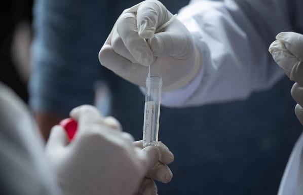 مراكز فحص كورونا العاملة يوم غد الجمعة  أسماء