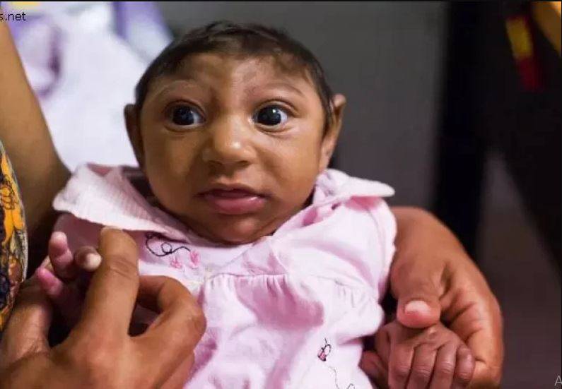 مخاوف من جائحة جديدة تضرب العالم بعد كورونا.. تسبب ولادة أطفال برؤوس صغيرة