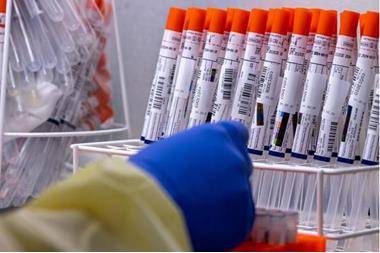 مركز إحصاء يكشف أعلى دولة خليجية في نسبة الشفاء من كورونا