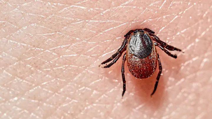 يسبب شلل الوجه.. مرض لايم الذي تنقله حشرة القراد