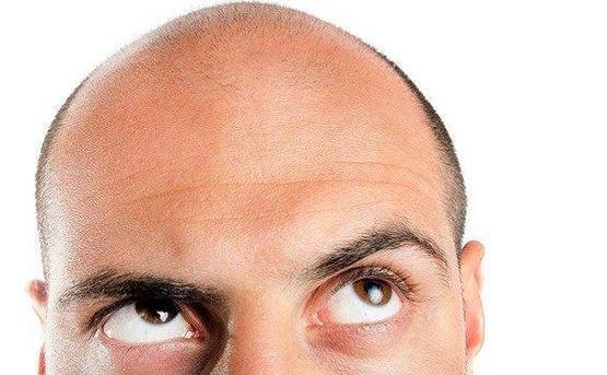 عالمة تكشف لماذا يفضل كورونا قتل الرجال الصُلع