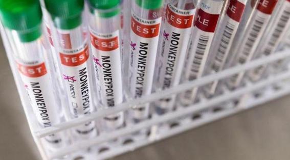 سلوفينيا تسجل أول إصابة بجدري القرود