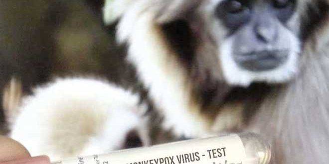 نيجيريا تسجل 21 إصابة مؤكدة بجدري القردة