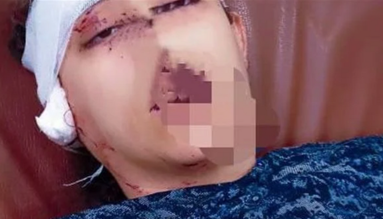 مصري يقطع أذن زوجته: مبتسمعش الكلام