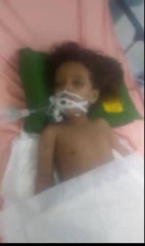 جريمة بشعة تعذيب طفلة حتى الموت على يد زوجة والدها في صنعاء..