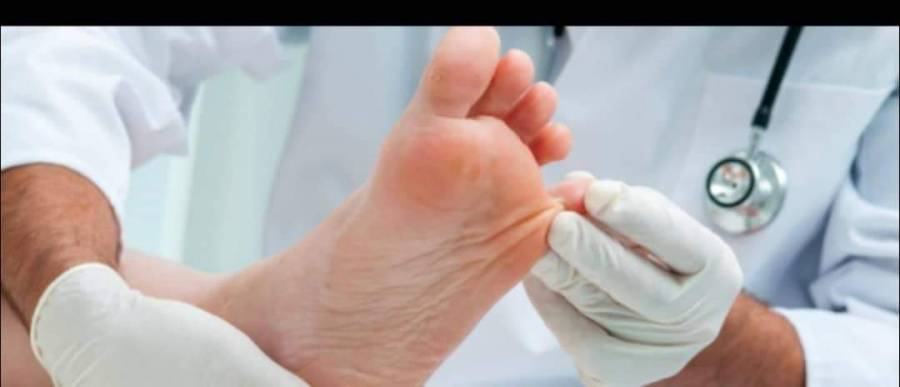 طرق للعناية بجروح مرضى السكري ..تفاصيل