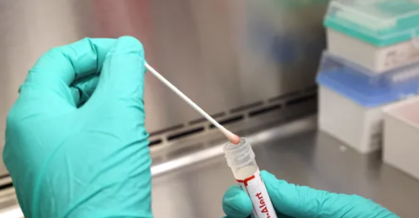 مسؤول بمنظمة الصحة يكشف  وضع فيروس ماربورغ