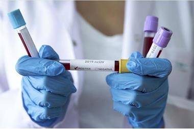 بعد مقاومة لعامين ونصف.. كورونا يدخل ميكرونيسيا