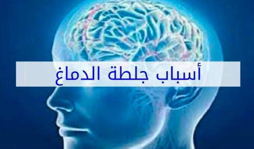أسباب الجلطة الدماغية