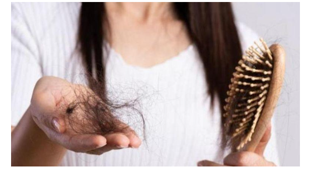 تساقط الشعر.. أعراض تستدعي استشارة الطبيب
