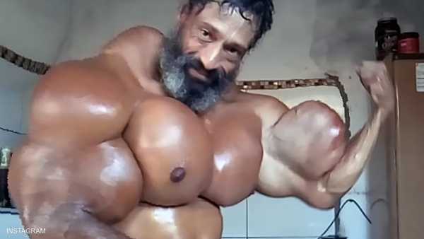 وفاة الهلك البرازيلي بحقنة زيت عضلات