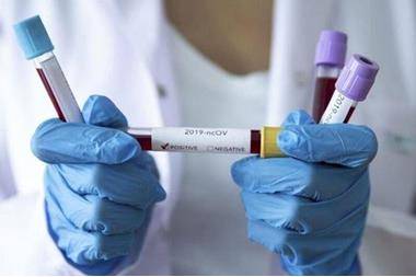 وكالة تاس : استمرار انخفاض إصابات كورونا عالميا للأسبوع الثالث