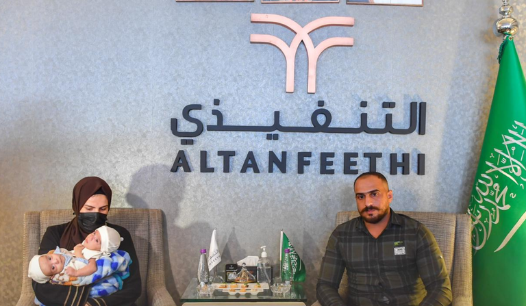 وصول التوأم السيامي العراقي عمر وعلي إلى السعودية