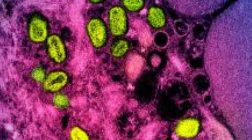 الصين تسجل أول إصابة بـ«جدري القردة»