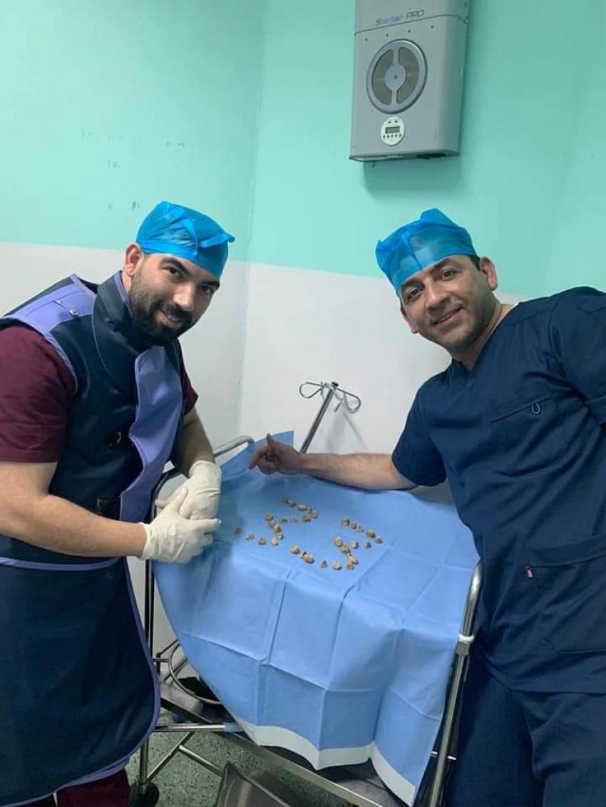 إزالة 33 حصوة من مثانة رجل خمسيني في مستشفى البشير