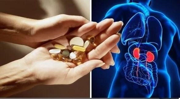 مكمل غذائي يمكن أن يسبب ضرراً دائماً للكلى