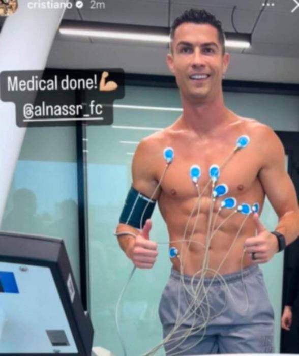 نتيجة الكشف الطبي  لرونالدو مع النصر السعودي