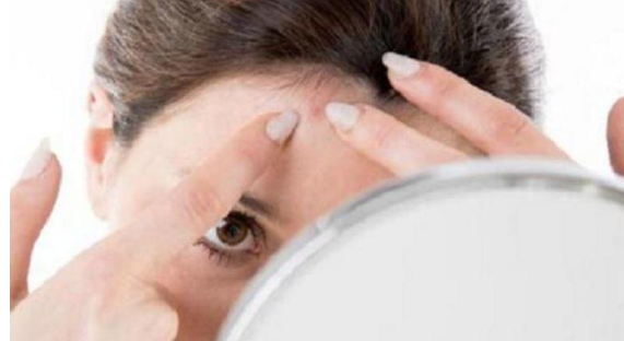 البثور الهرمونية على جسم المرأة.. حلول نهائية