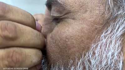 طبيب سوري يعالج مرضاه بلسعات النحل
