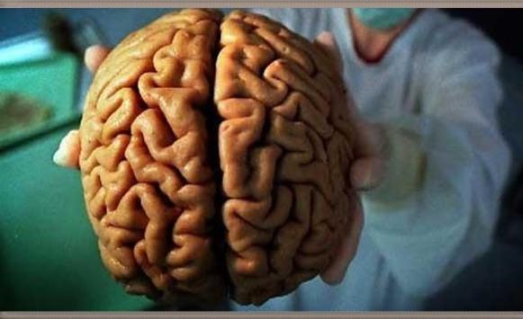 5 أسباب صادمة تؤدي للإصابة بـورم المخ
