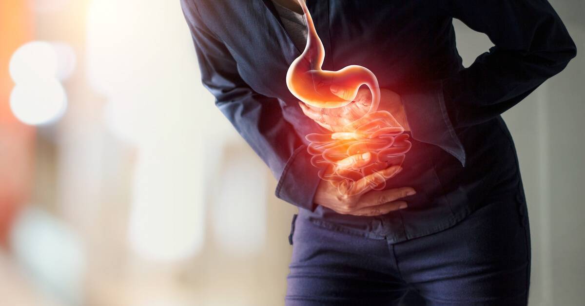 طرق لعلاج حموضة المعدة