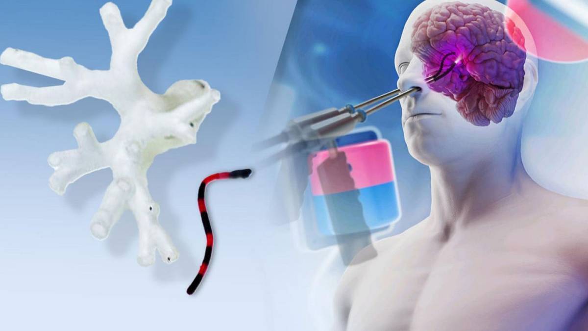 اكتشاف علمي لعلاج السرطان دون تدخل جراحي
