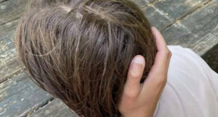 فتل الرقبة .. تحد قاتل يغزو تيك توك ويثير هلعاً بالمدارس