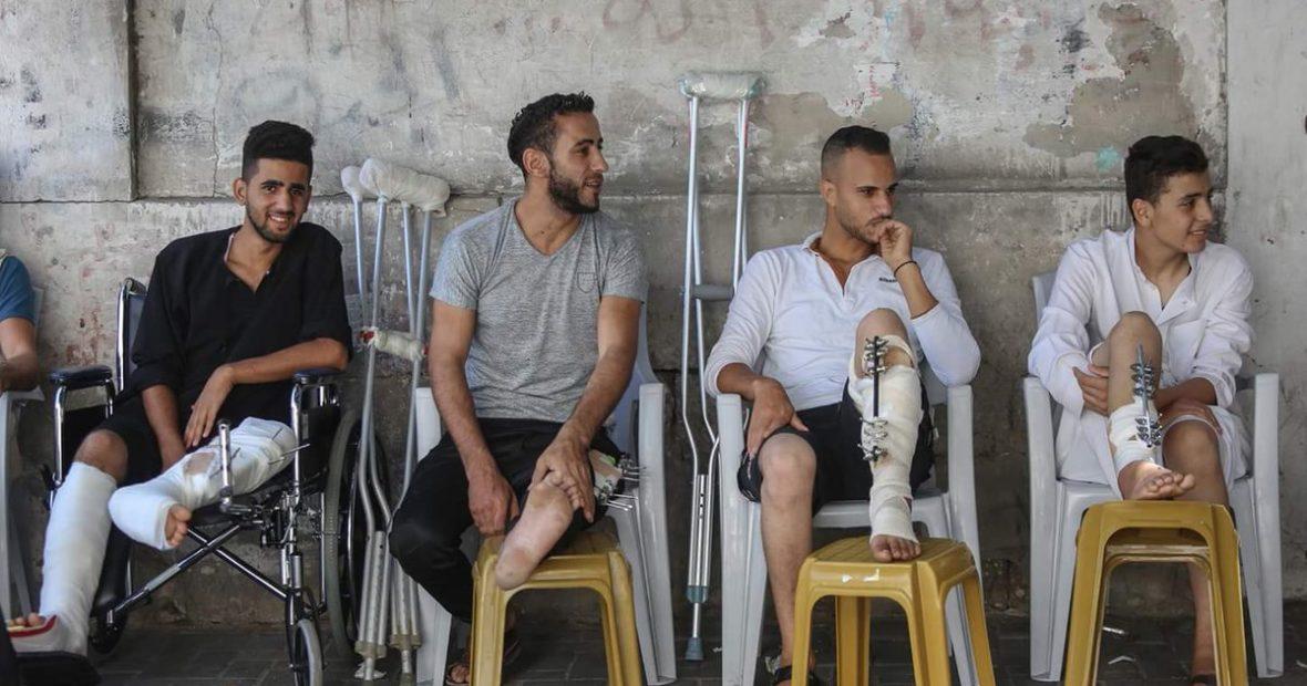 عمليات بتر الأطراف بغزة تجري دون تخدير
