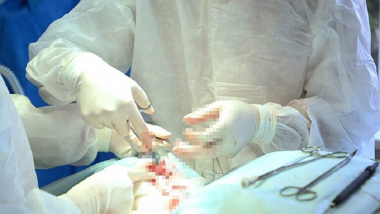 استبدال فك تالف لامرأة بآخر من التيتانيوم