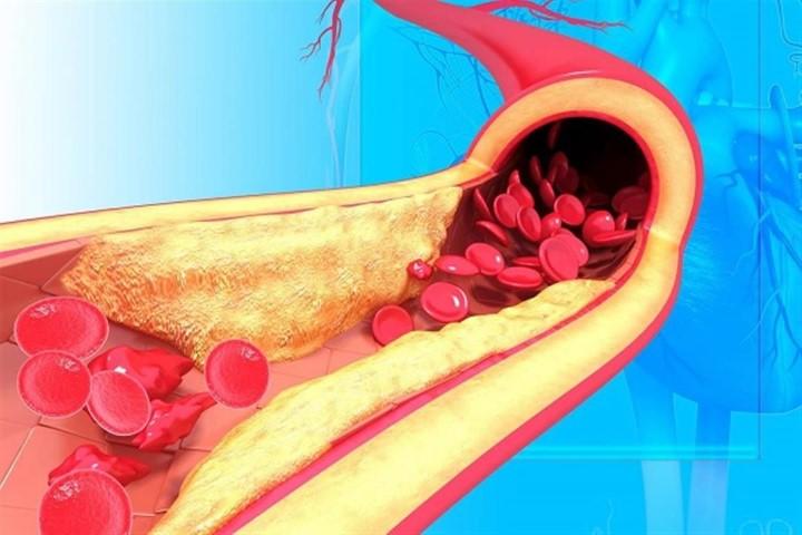 5 أطعمة مهمة للوقاية من أمراض القلب وتخفض الكوليسترول