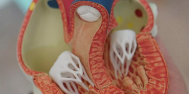 نجاح أول عملية زرع أجزاء قلب لطفل في العالم