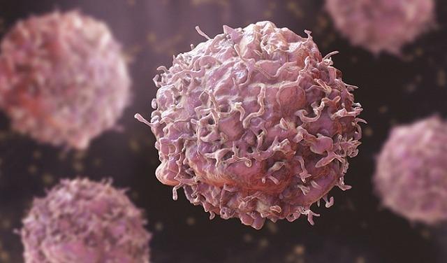 الصحّة العالميّة: الإصابات الجديدة بالسرطان سترتفع 77 بحلول 2050