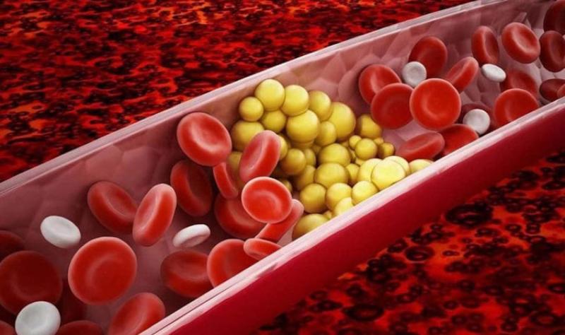 إليكم .. طرق طبيعية لتنظيف الأوعية والشرايين يوميًا