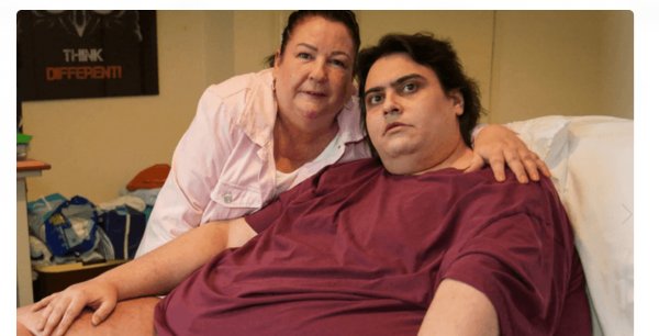 بعد وفاته .. أثقل رجل في بريطانيا يعاني من تبعات جسده الضخم