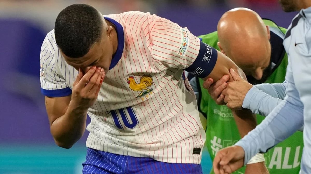 الاتحاد الفرنسي يعلن حجم إصابة مبابي