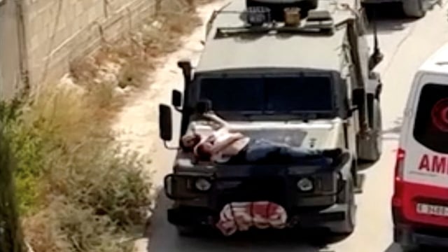 أمريكا تعلق على تقييد جريح فلسطيني بمقدمة جيب إسرائيلي