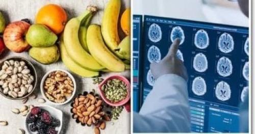 أطعمة تقلل خطر الإصابة بمرض ألزهايمر