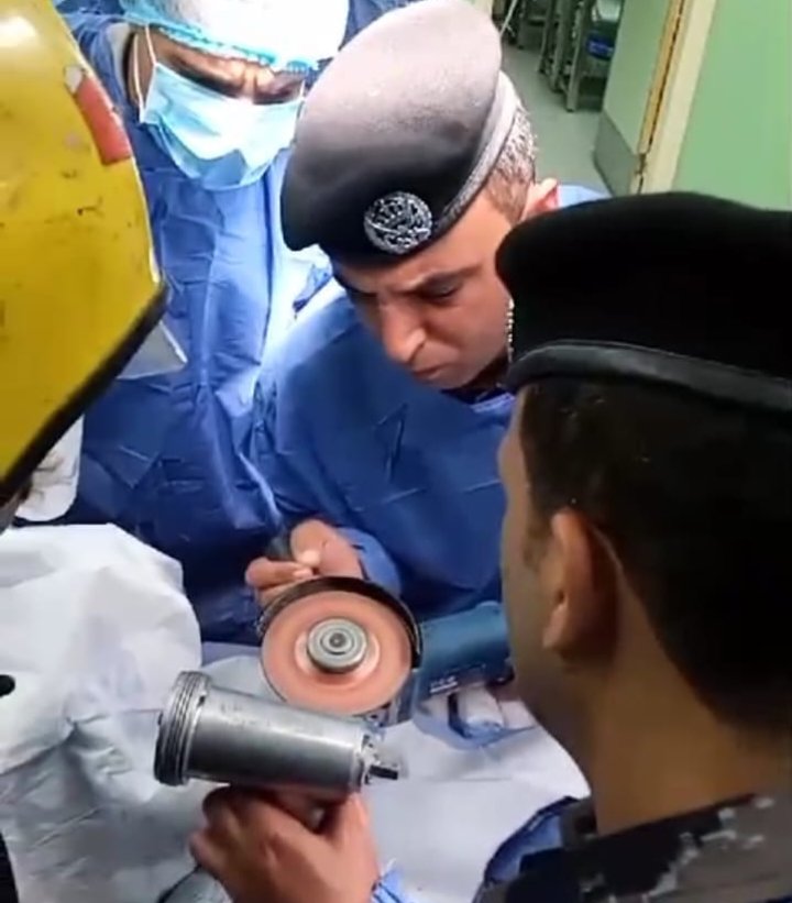 بالصور .. الدفاع المدني يحرّر يد طفلة علقت في ماكينة فرم لحوم