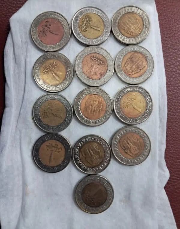 نجاح فريق طبي في استخراج 13 عملة معدنية من معدة طفل