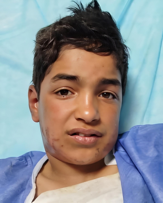 الخبير القانوني: لا محاسبة للأطفال دون 12 عامًا
