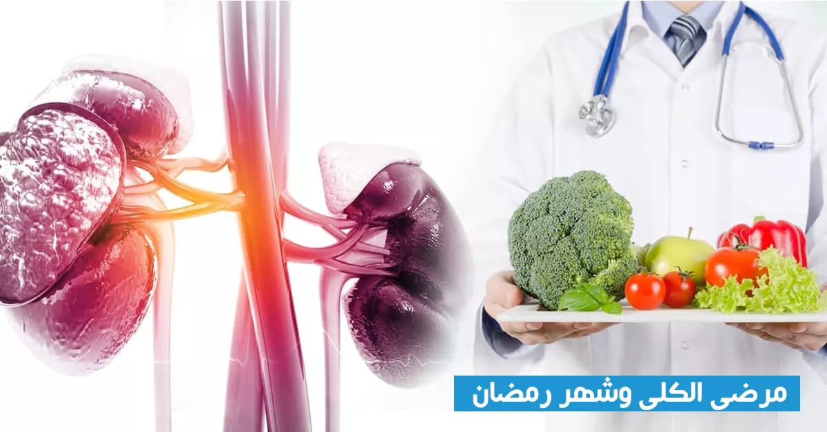 نصائح صحية لمرضى الكلى في شهر رمضان