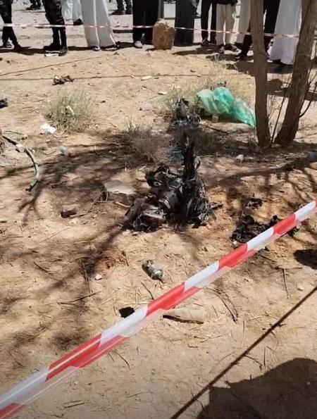 مستشفى الزرقاء: حالة الأطفال المصابين جراء سقوط جسم غريب حسنة