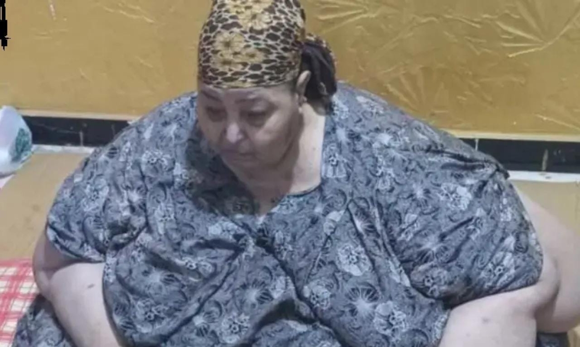الحاجة المصرية فاطمة سجينة جسدها منذ 15 عاماً