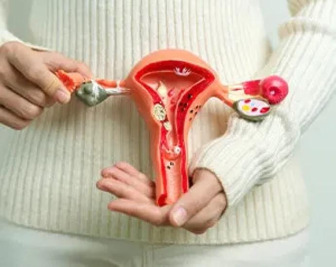 مرض يسبب العقم .. ما لا تعرفه عن بطانة الرحم المهاجرة وطرق الوقاية منه