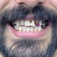 هل حلمت بسقوط أسنانك؟ إليك التفسير الكامل للرجل والمرأة المتزوجة