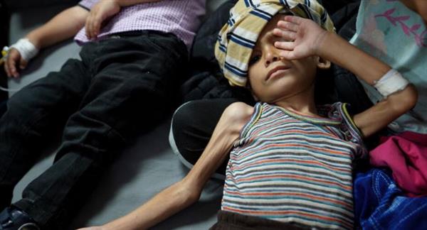 استشهاد 21 طفلا فلسطينيا بسبب سوء التغذية والمجاعة في غزة